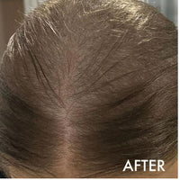 La Biosthetique Methode Regenerante Hairloss Control Scalp C 10 x 10ml