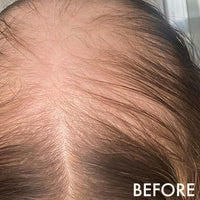 La Biosthetique Methode Regenerante Hairloss Control Scalp C 10 x 10ml