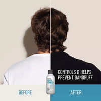 KMS Head Remedy Anti Dandruff Shampoo 300ml
