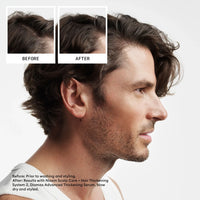 Nioxin System 2 Hair System Trial Kit