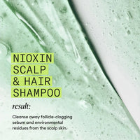 Nioxin System 2 Scalp + Hair Shampoo 1L