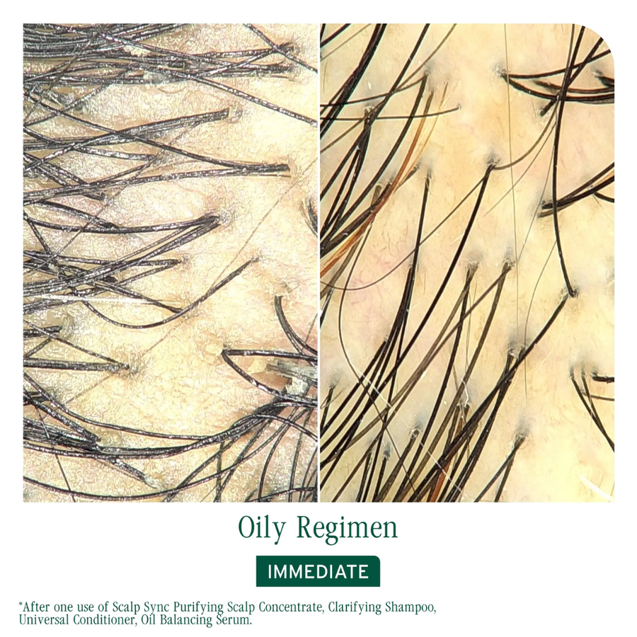 Matrix Biolage Scalp Sync Calming Shampoo 400ml