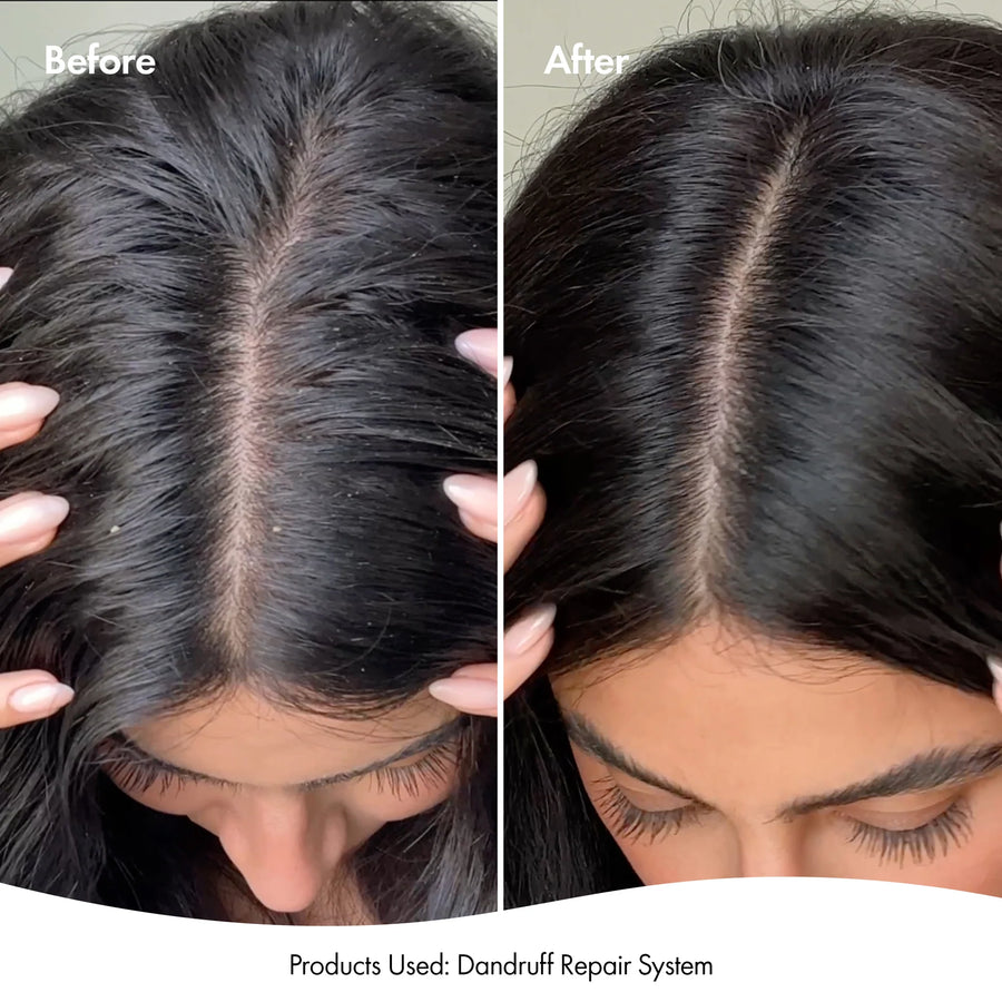 Bondi Boost Dandruff Repair Leave In Scalp Serum 125ml