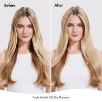 Bondi Boost Hair Growth Dry Shampoo 200ml